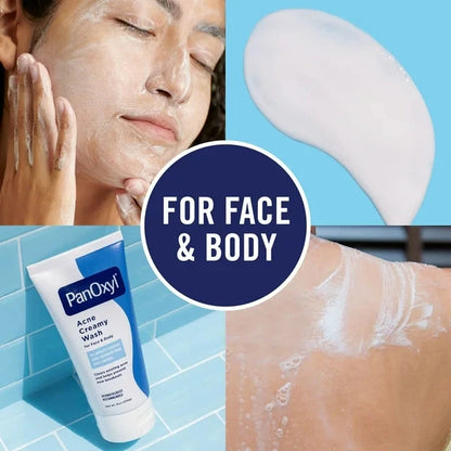 PanOxyl Nettoyant Crémeux Anti-Acné 4%(170g)
